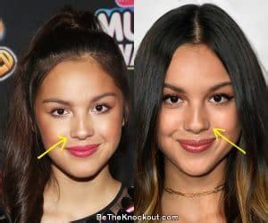 did olivia rodrigo get breast implants|Celebrities with Breast Implants 